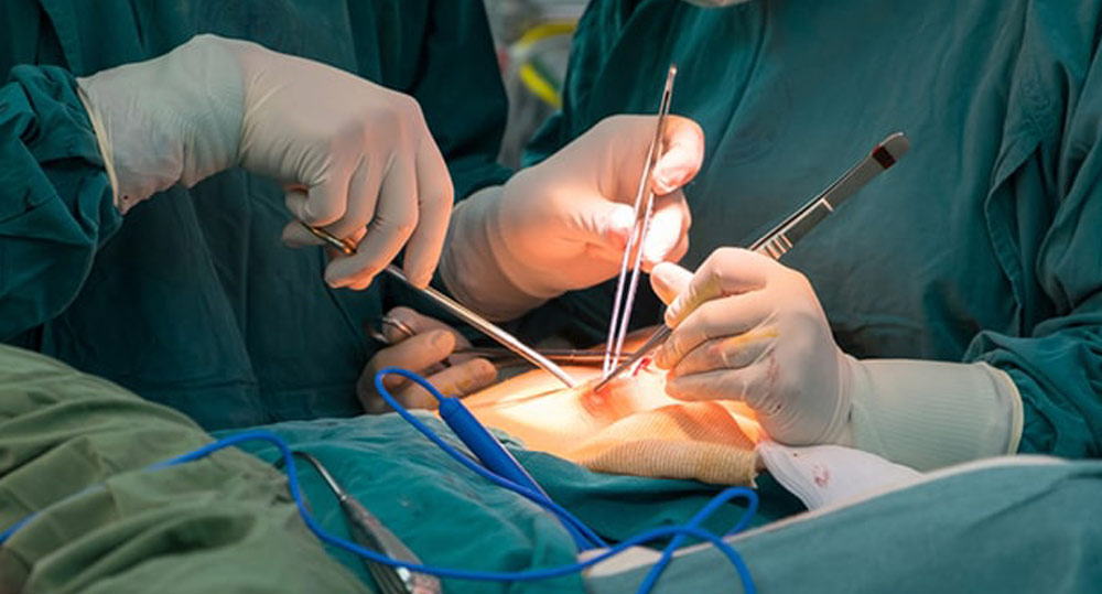 general surgery