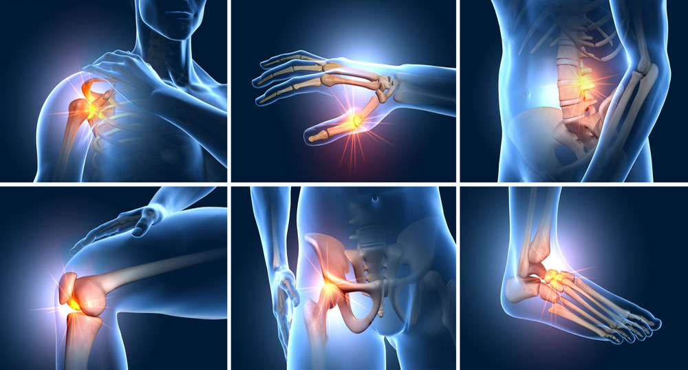 orthopedics